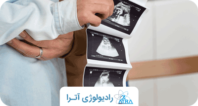 تأثیر رادیولوژی زنان باردار و جنین 
